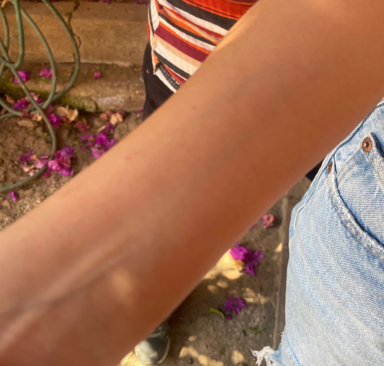 Cuida tu piel de los rayos solares