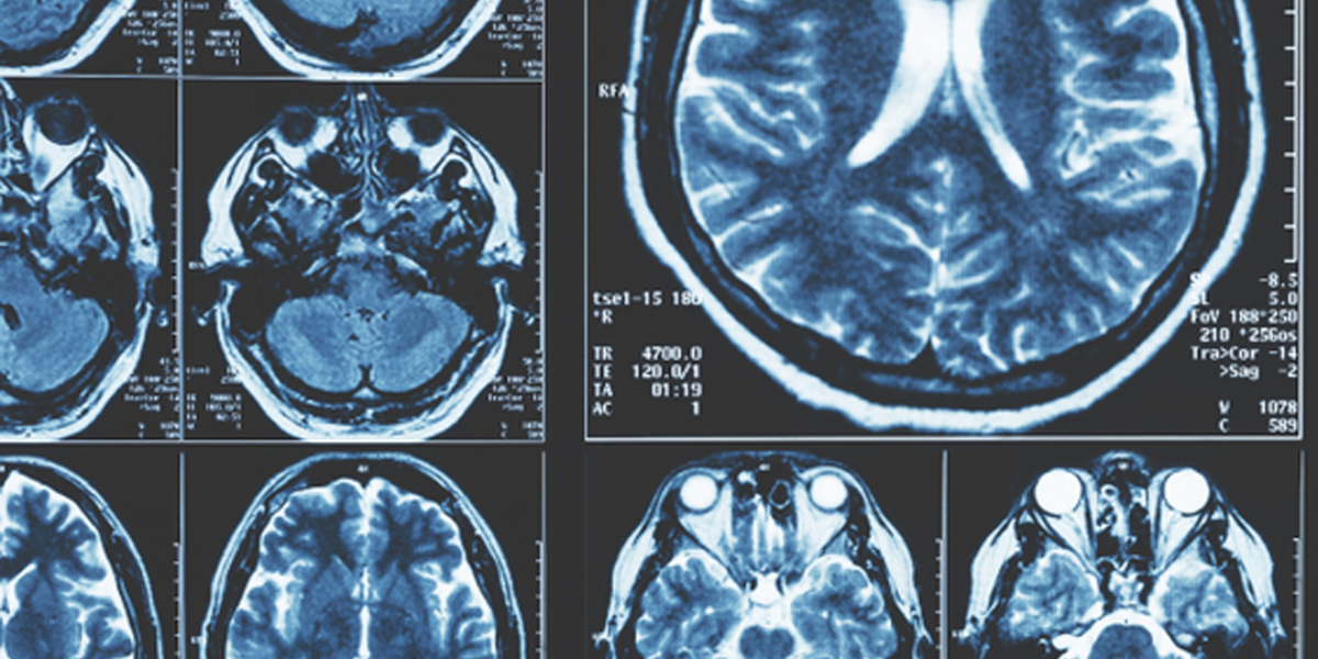 El cerebro se conforma de millones de neuronas que trabajan todo el día. 