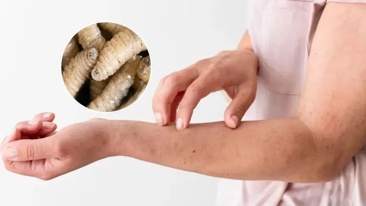 Primer fallecimiento por gusano barrenador en México; se trata de una mujer