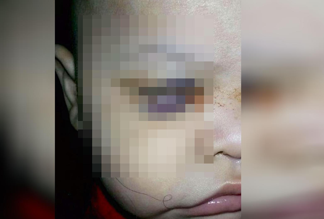 “Errar es de humanos”: esposa de médico que extrajo ojo a bebé