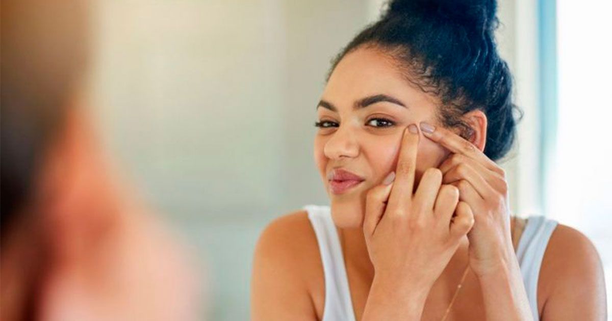 El acné y sus estragos