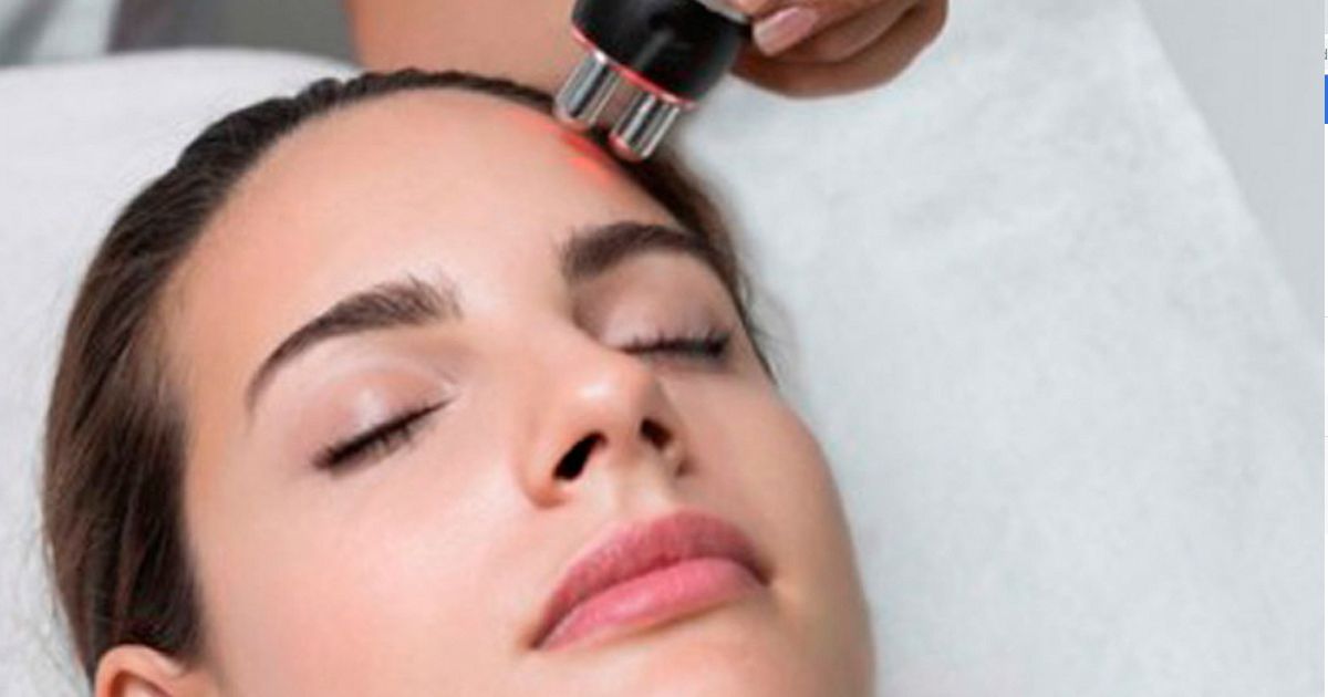 Conoce qué es la radiofrecuencia fraxeliada