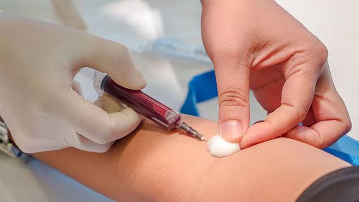 24 Morelos Prueba de Sangre