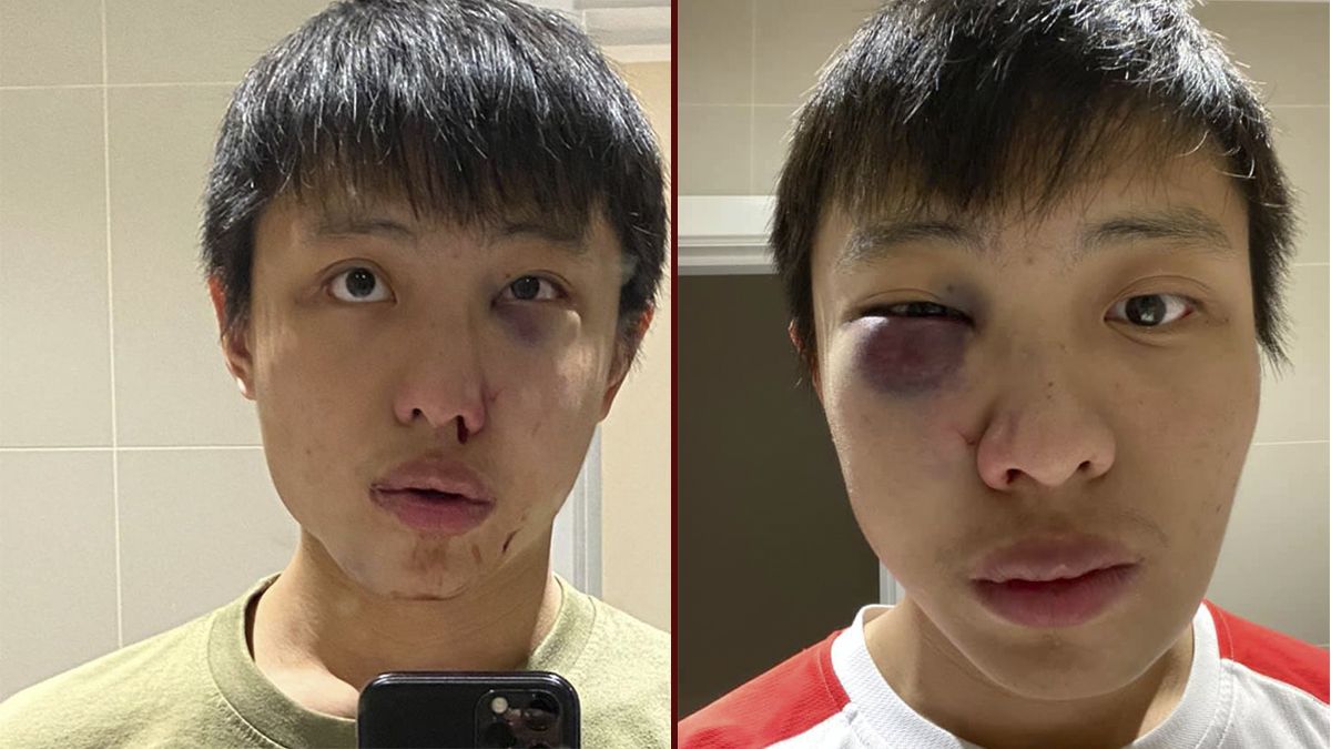 24 Morelos Asiático golepado discriminación coronavirus