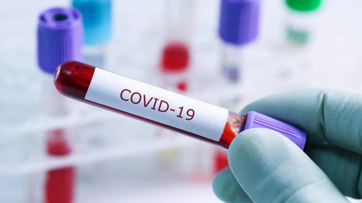 Dará IMSS apoyo económico para gastos funerarios de personas fallecidas por Covid-19