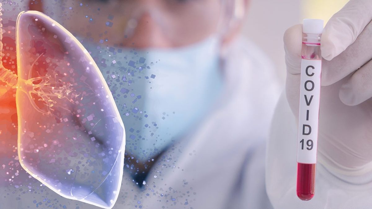 Colima reportó primera muerte por Covid-19