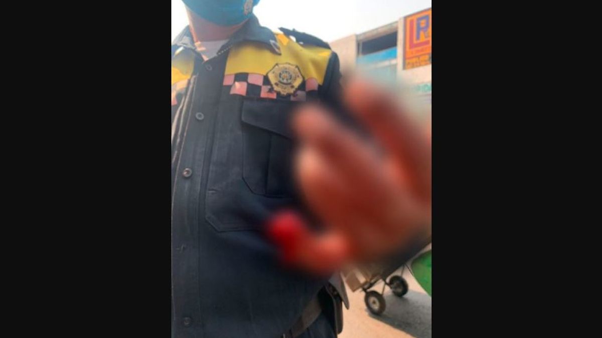 Mordió al policía vial que inmovilizó su auto por estar mal estacionado