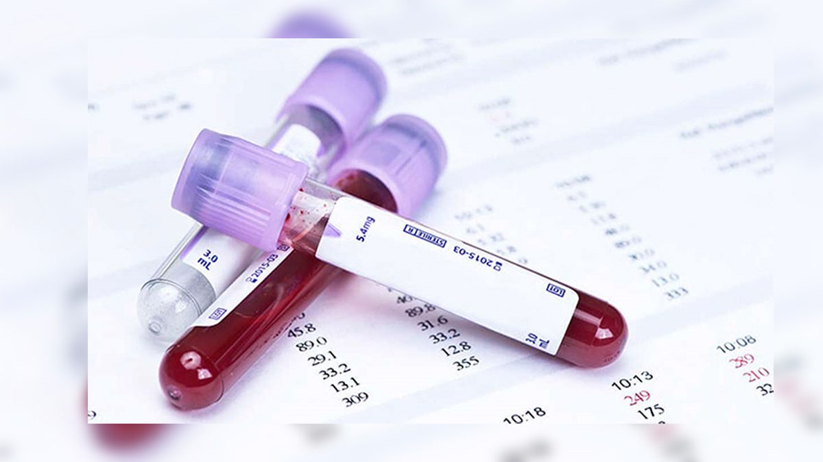 Realiza IMPAJOVEN aplicación de pruebas de detección de ITS