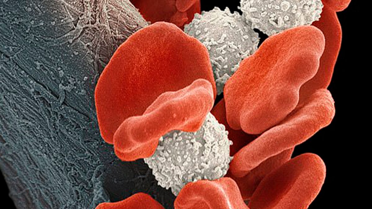 Recibe mujer peligroso tratamiento contra el VIH