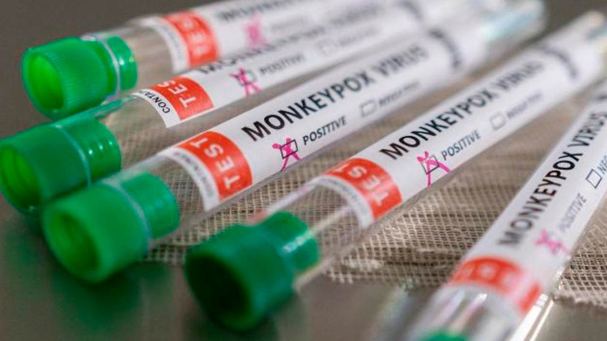 Lo que debes saber de la viruela del mono… ¿Qué es? ¿Cómo se transmite?