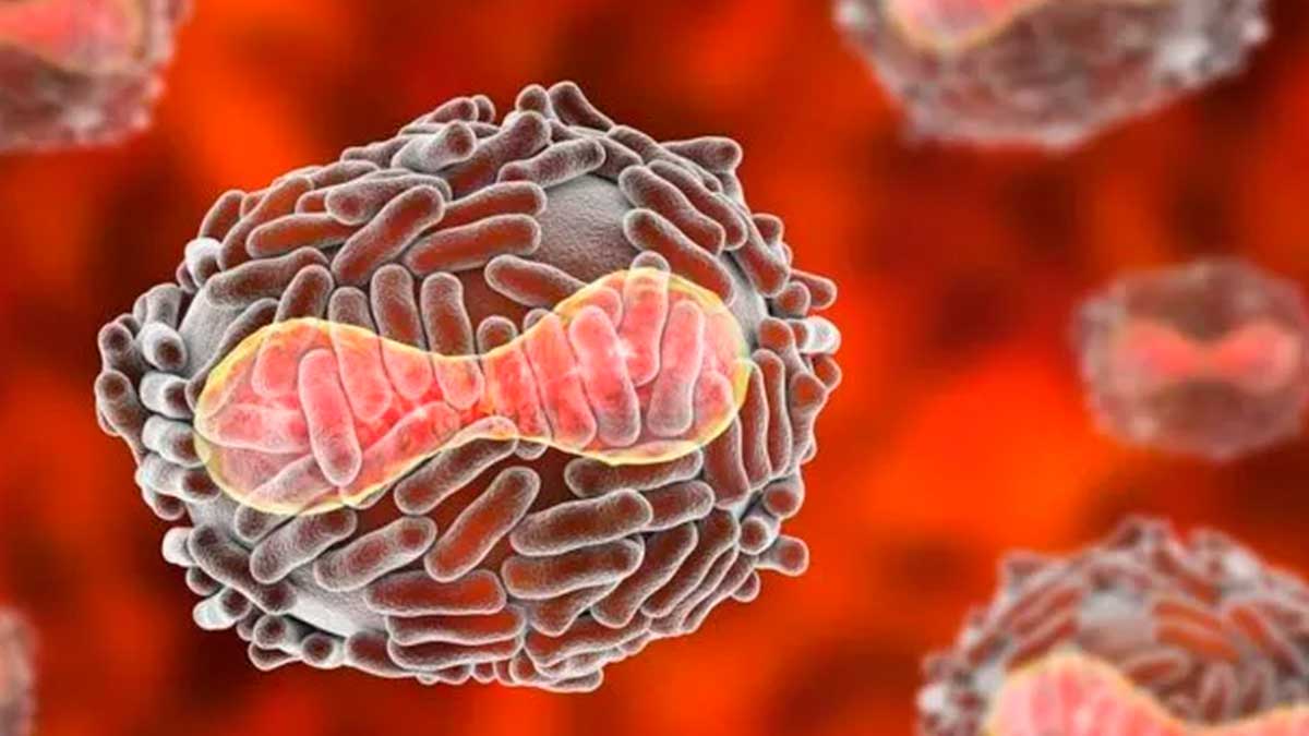 Sin casos de viruela símica en Morelos